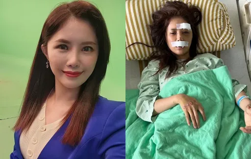 美女主播车祸毁容眼眶断裂 手术7小时重建脸部恐留后遗症