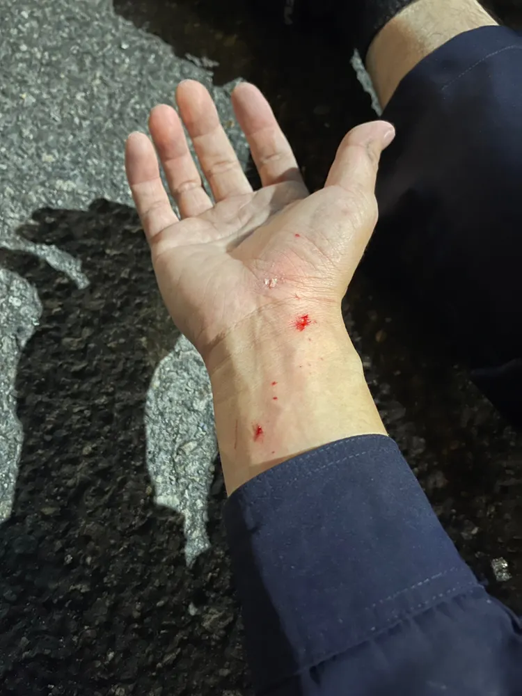另名警員手部被玻璃割傷。民眾提供