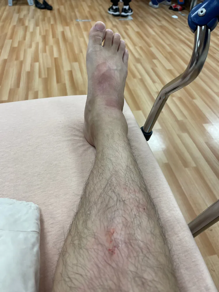 1名警員右腳被壓傷。民眾提供