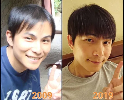 孫協志嚴重掉髮痛失戲約 嗆網友不要再說他是禿子