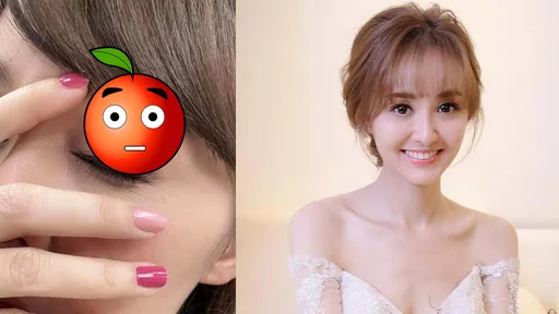 美女主播認了「是的我被家暴了!」 曝眼窩瘀青:沒想過會被下重手