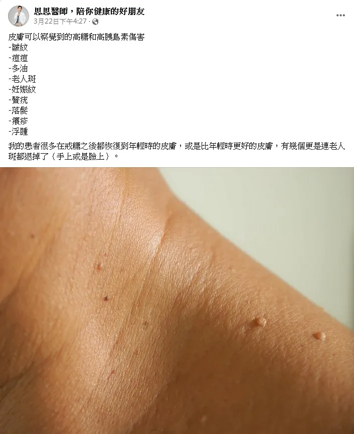 家醫科李思賢醫生提醒民眾，「糖」對人體造成的危害比你想像多更多。翻攝《思思醫師，陪你健康的好朋友》粉絲頁