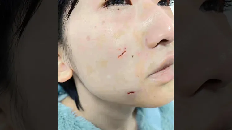 網美的臉部傷勢。翻攝自微博