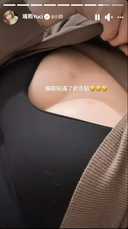 瑀熙大方公開自己「上圍升級」秘方，是用針灸貼讓胸部UP UP。翻攝《瑀熙Yuci》粉絲頁