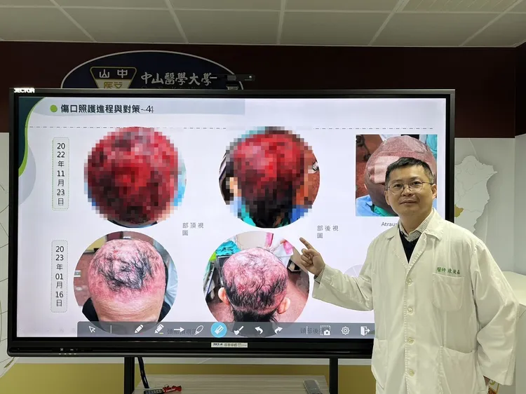 中山附醫整形外科主任陳俊嘉說明治療過程。中山附醫提供