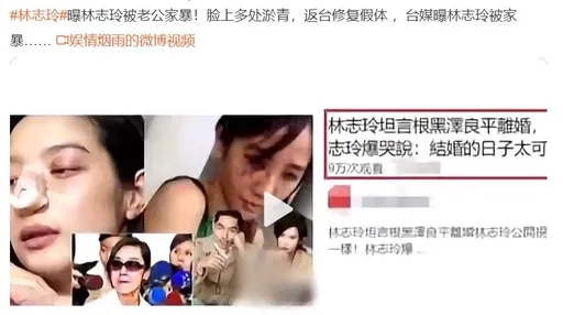 微博瞎傳林志玲被AKIRA家暴打出隆鼻假體　滿臉傷照片網友看了驚呆