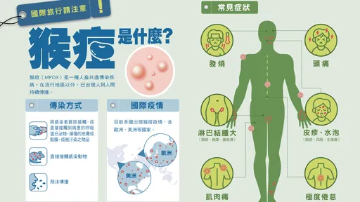 高雄本土第3例!肛门口冒水泡 男确诊猴痘没出国史