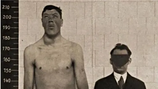 【奇人奇事】同時患侏儒症與巨人症 他從122公分爆長到216公分