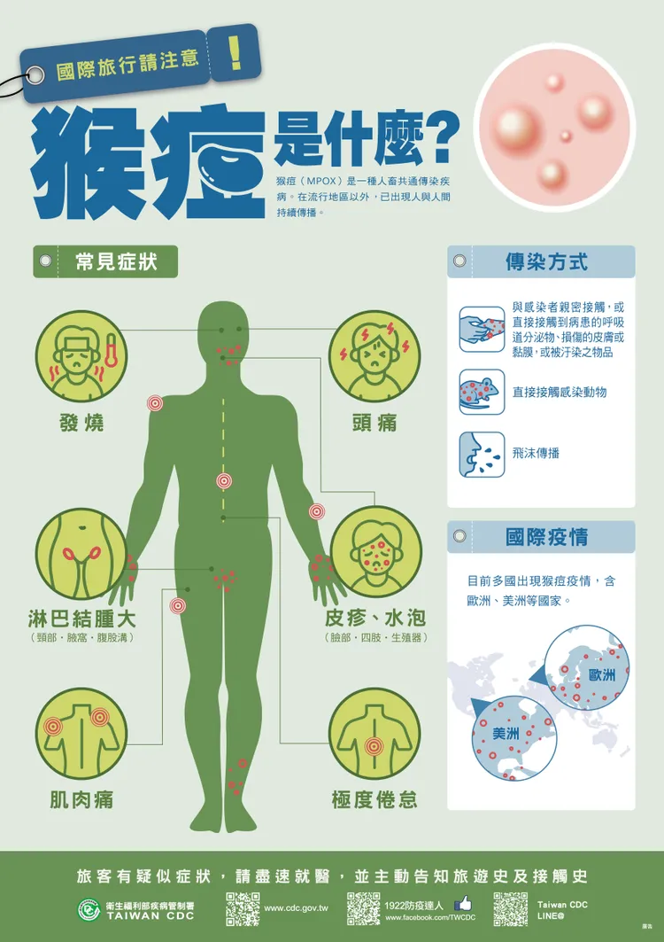 高雄出現首例猴痘病例，個案為20多歲近期無出國的男子，研判是本土病例。衛生局提供