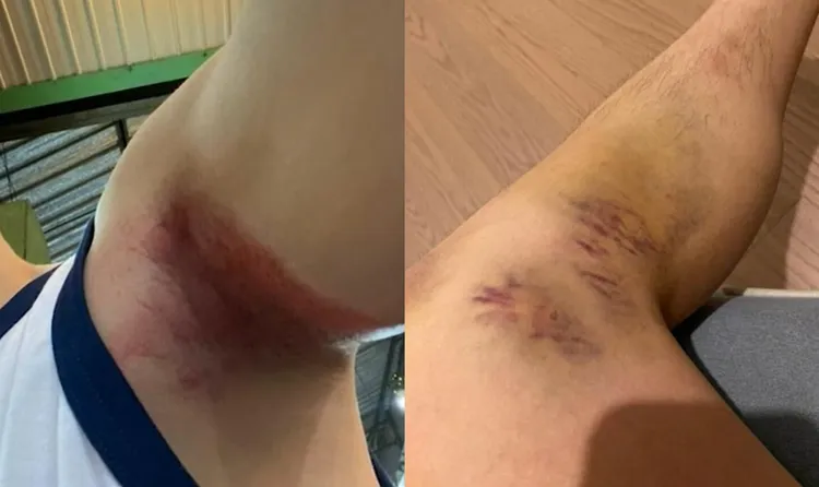 他大難不死，但身上遍體傷痕。翻攝CNN