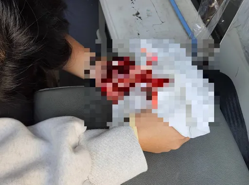 警逮通緝犯開槍! 妻中彈血濺車內 他竟丟包自己落跑