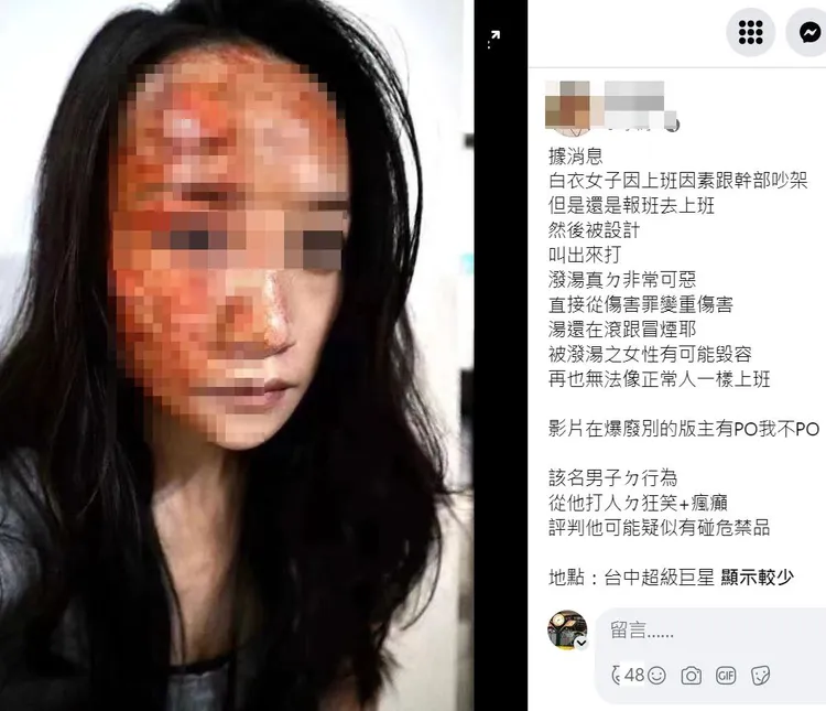網路瘋傳疑似傷者毀容照。翻攝自爆廢公社