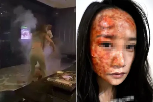 网疯传遭泼热汤妹子「毁容惨照」　她现身46字诉真相：谢谢大家关心