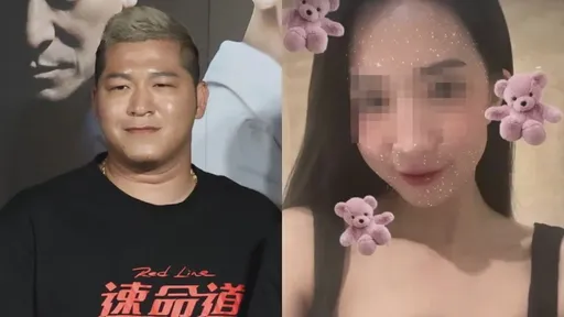 草爺不捨八大女被熱湯毀容 曝2人已聯絡上揭植皮手術進度