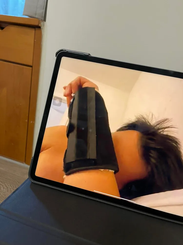 張育成傷勢照曝光！翻攝臉書「張育成 Yu Chang」