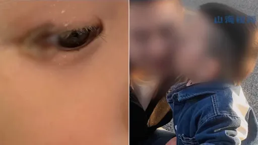 爸爸手一揮「香菸插進稚兒眼睛」 孩崩潰痛哭緊急送醫