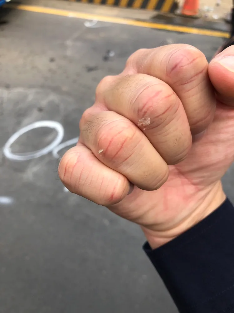 警員手部遭碎玻璃割傷。大園警分局提供