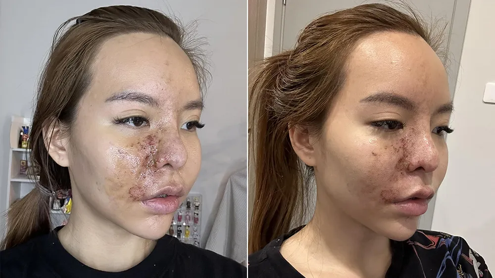 瑪里曝光自己「整容變毀容」的慘況。翻攝自瑪里臉書