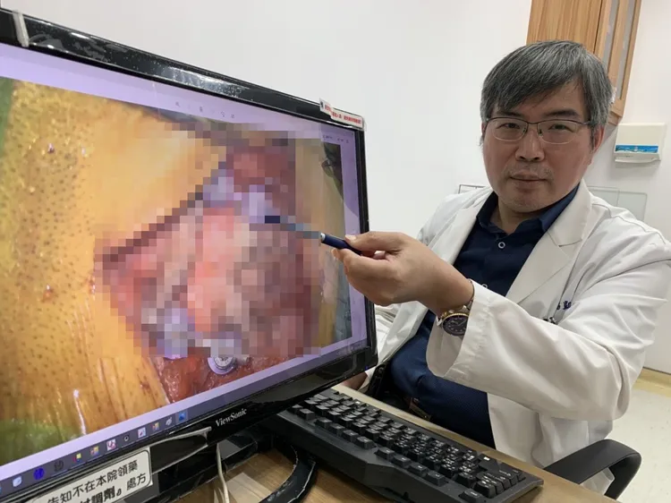 鄒錫凱採用3D導航與最新的AR擴增實境技術，透過頸椎一道小傷口，成功的植入第一與第二頸椎骨釘。鄒錫凱提供