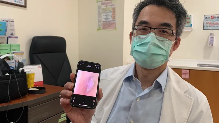 楊顓謙醫師指大叔因右耳道殘留棉花棒頭導致發炎，並出示大叔右耳道被粉紅肉芽組織填滿的照片。吳慧芬攝