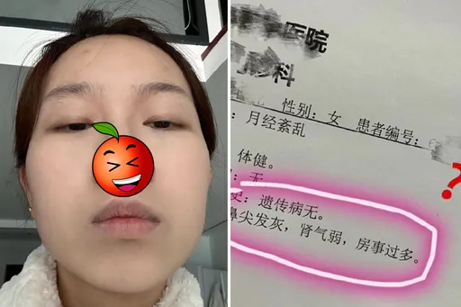 女子暗瘡就診!老中醫斷言鼻尖發灰「房事過多」 母苦勸:別太放縱