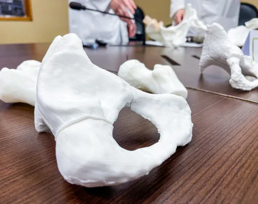 粗重工作不是致病主因! 髖關節發育不良做「這2動作」更痛快就醫