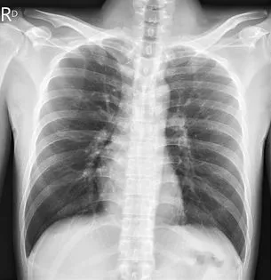 治療後有明顯改善。取自蘇一峰臉書