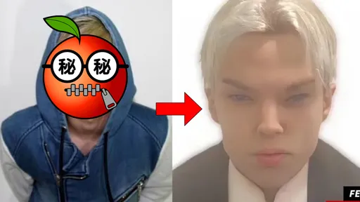加拿大男星砸680万「变脸BTS」 整形12次不幸过世终年22岁