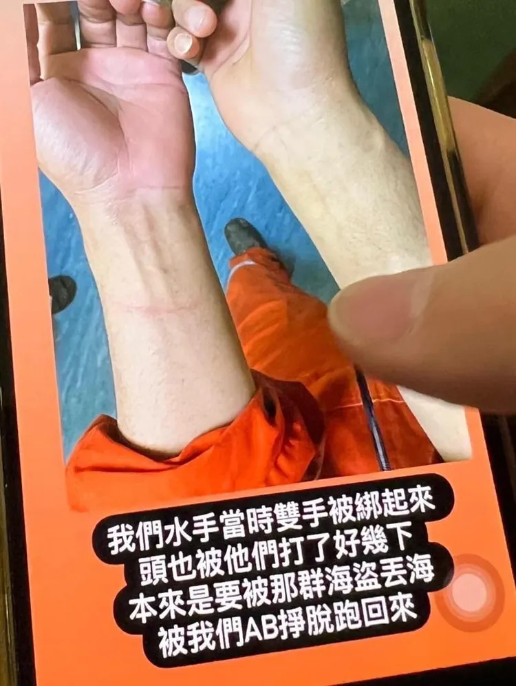 長榮印尼籍水手遭海盜綑綁，雙手留下被綑綁痕跡。讀者提供