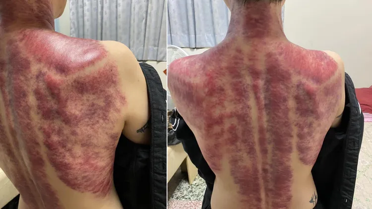 金曲台語歌后詹雅雯裸背「血痕」太驚人！翻攝臉書「詹雅雯 Y.W」