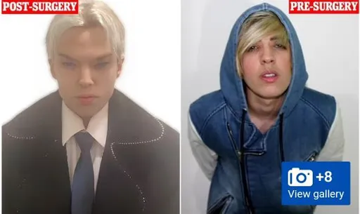 打假!外媒改口 加拿大男星想整成BTS不幸身亡「查無此事」