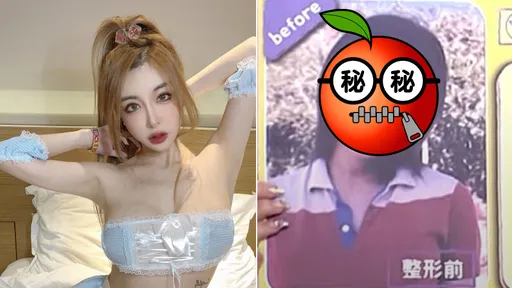「情色教主」雪碧高中嫩照出土 一原因整形已花800萬!痛呼腦漿快爆出