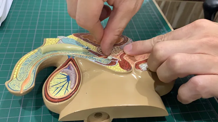 逆行性射精會致使男性射精時，精液往內衝，而不是從尿道射出。吳慧芬攝 