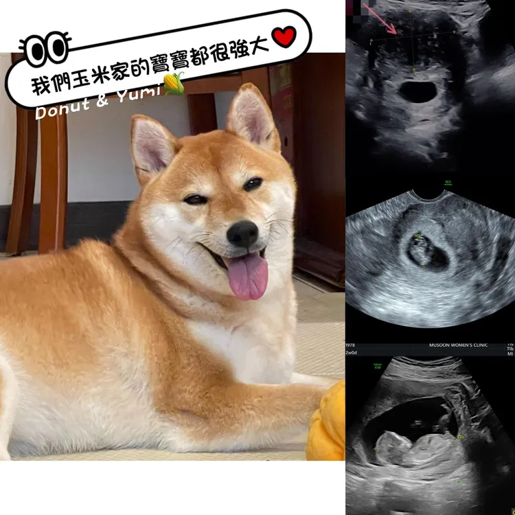 秦綾謙曝懷孕後，肌腺瘤神奇在產檢時找不到了。取自秦綾謙臉書