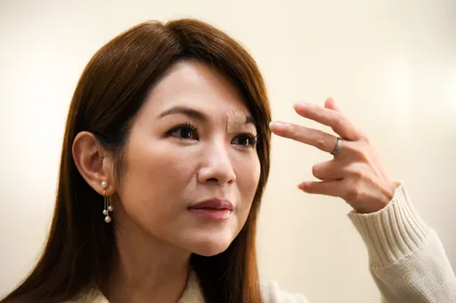 星卉才进剧组就摔破相 「脸缝10多针」《天道》急改剧本