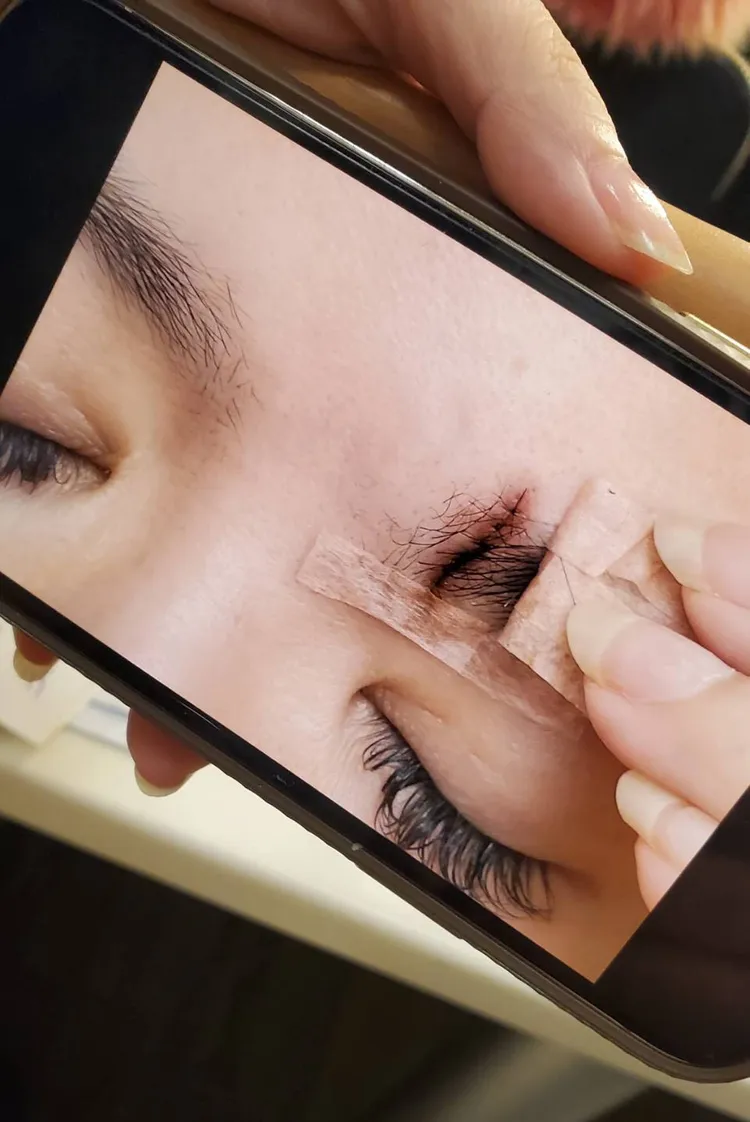 星卉縫了10多針。三立提供