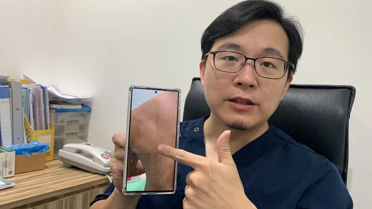 蘇信豪醫師說明男子在與陌生人發生危險性行為後染上梅毒，身體出現紅疹。吳慧芬攝