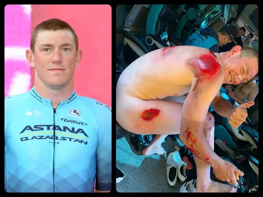 噢~痛!自行車手用裸照告訴你 賽道翻車的下場