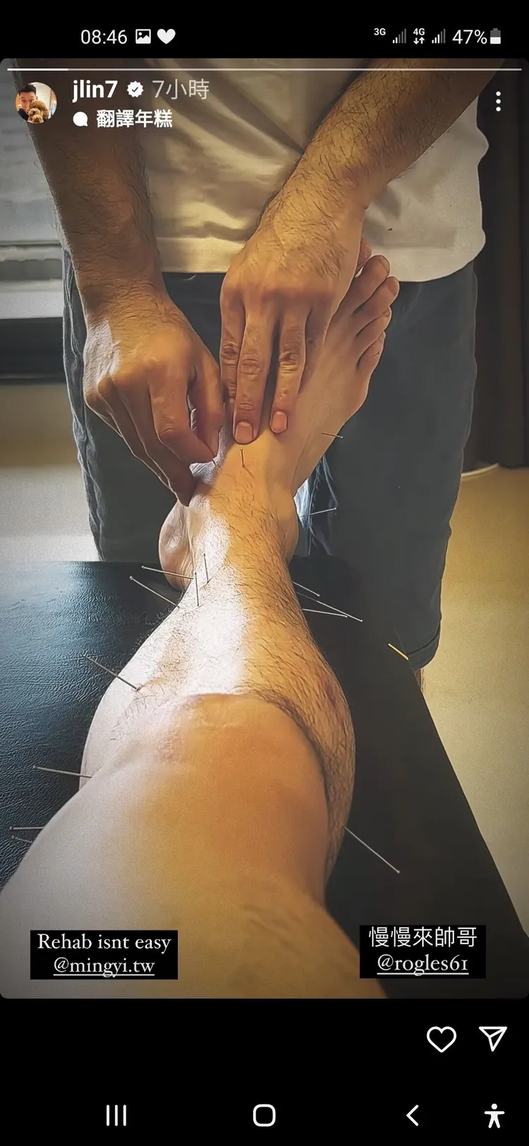 林書豪日前在IG上PO出被針灸照片，並標記「明易足體養生館」和「羅鈞諭」。 翻攝jlin7
