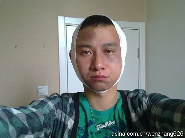 文章曾分享自己化「受傷妝」的照片。翻攝文章微博