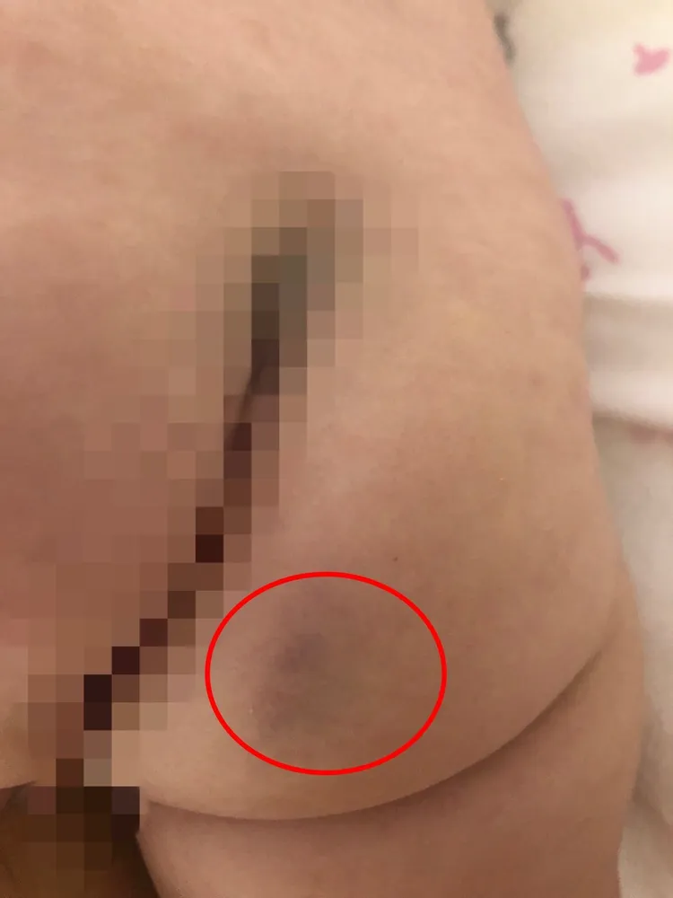 社會局指出，尚有其他托育老師，疑似涉及其他小孩的不當對待。洪婉臻辦公室提供