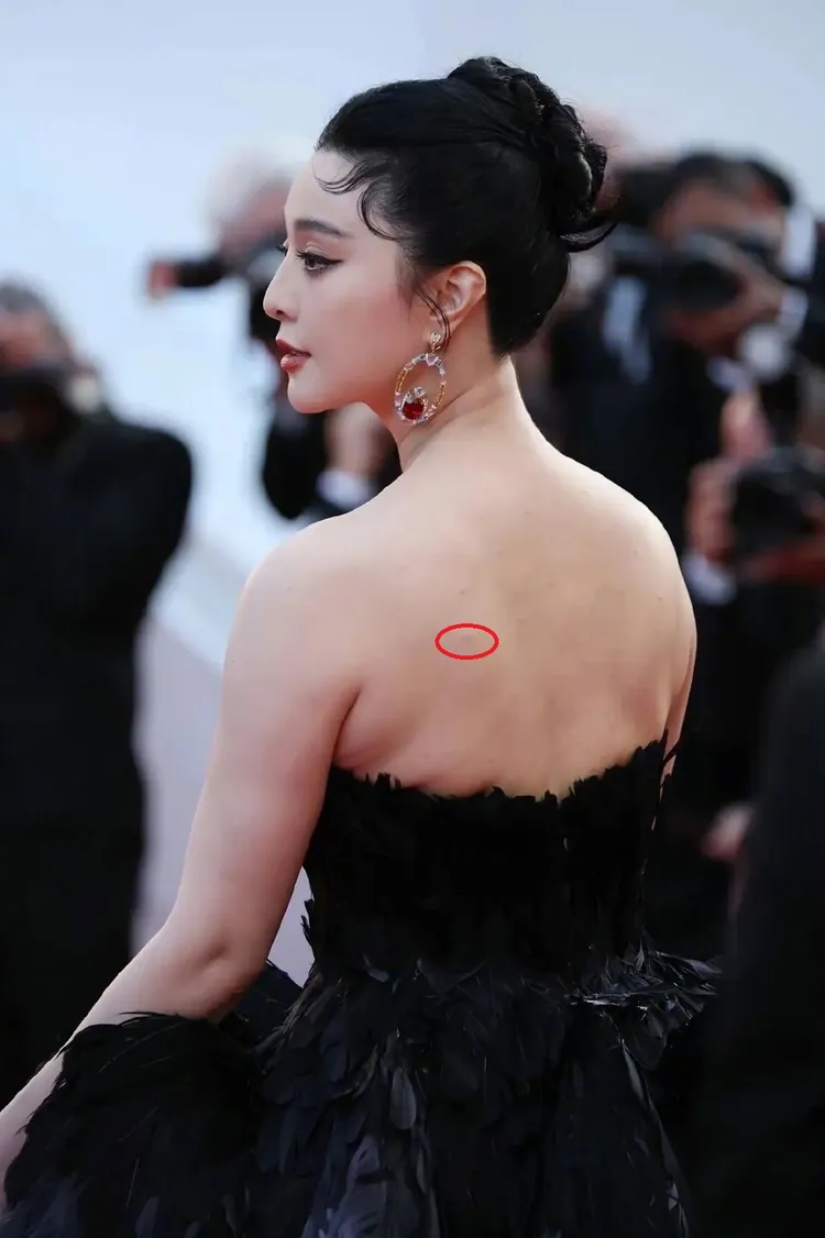 范冰冰被網友發現背上有痘痘（紅圈處），也說她肉有點鬆。翻攝雪霏sophia微博