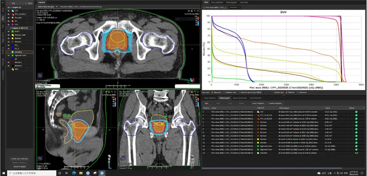 臨床試驗患者童先生的治療計畫。北榮提供