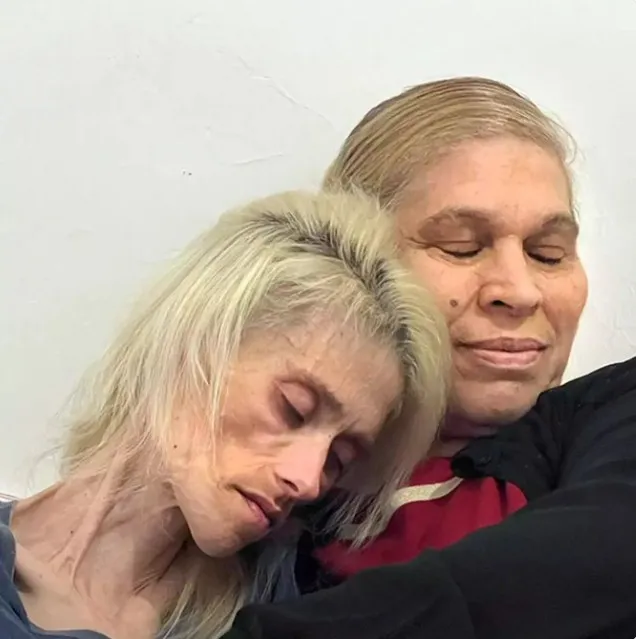 以色列名模卡琳鮑曼因罹患神經性厭食症13年，瘦成紙片人，上週二因感染肺炎惡化病逝。翻攝《THE TIMES OF ISRAEL》