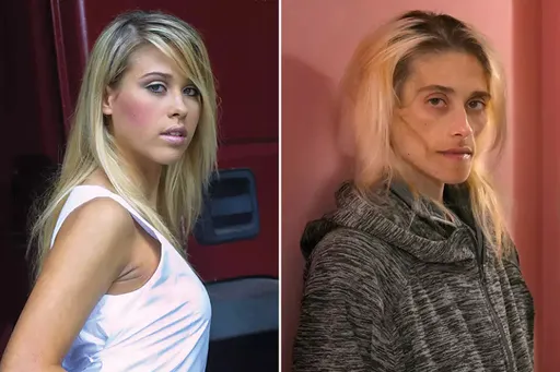 35歲以色列名模厭食症13年 瘦成23公斤紙片人病逝