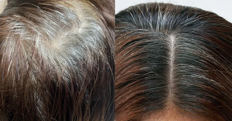 髮根只要長出一點白髮就好明顯，不僅看上去沒精神，還像老了10歲。