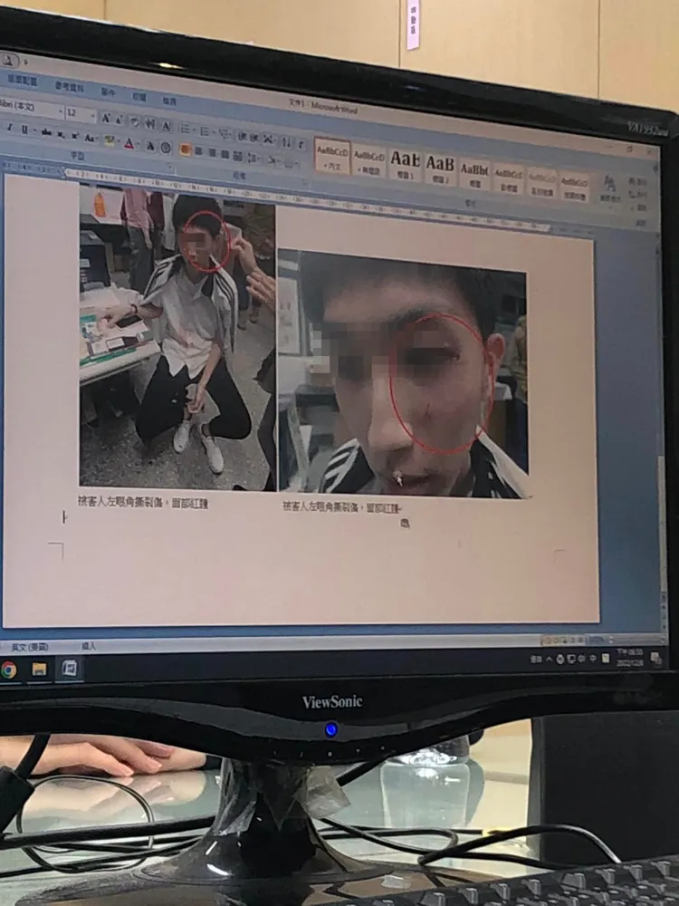 家長把疑似在警局做筆錄，翻拍王師傷勢照片畫面PO上網。翻攝自臉書「爆料公社」