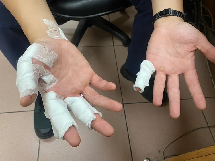 警員遭碎玻璃割傷。桃園警分局提供