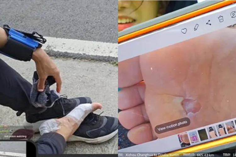 企鵝妹腳底傷勢曝光。取自企鵝妹twitch