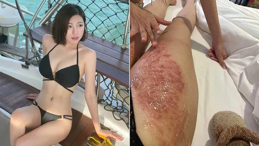 辣妹DJ比基尼潛水「美腿毀了」　海中遇襲！愛美沒做這件事「後悔一輩子」